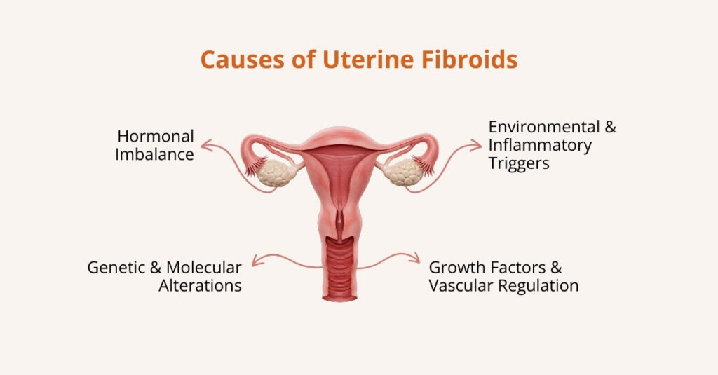 what are the causes of uterine fibroids