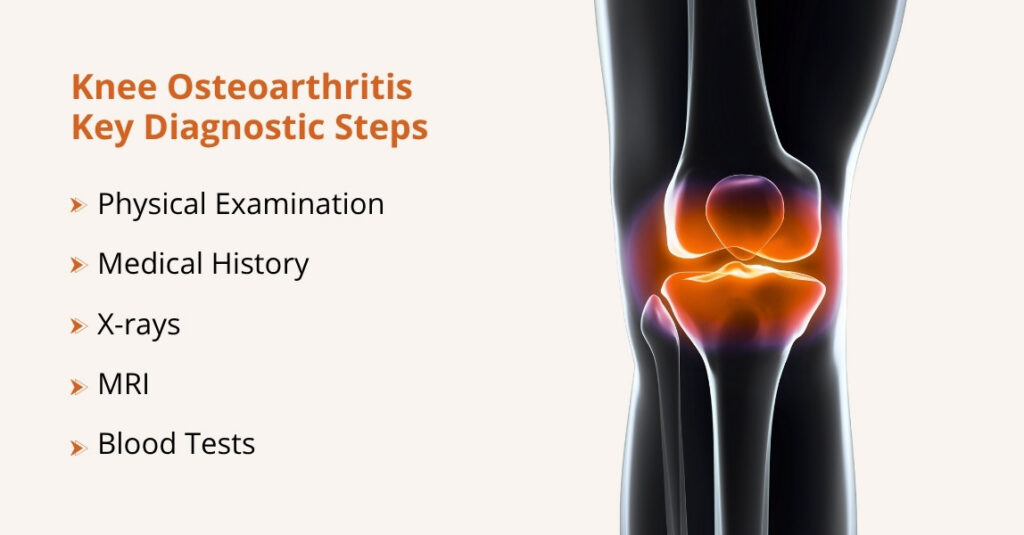 how is knee osteoarthritis diagnosed