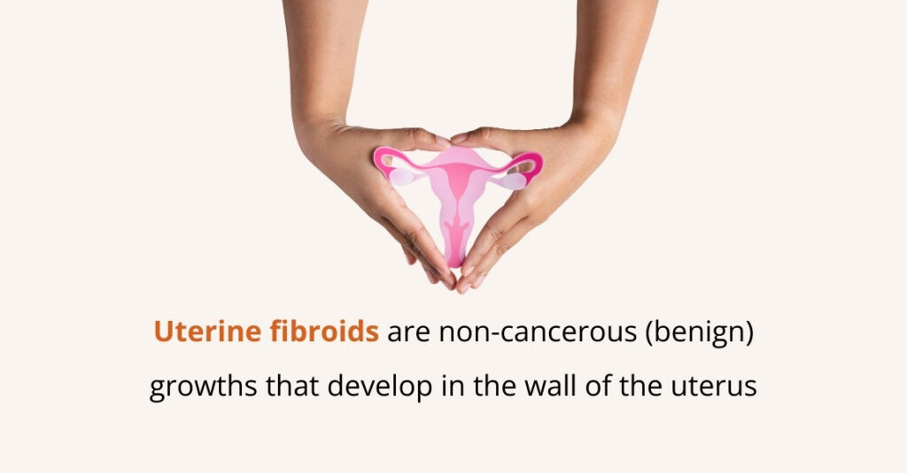 what are uterine fibroids