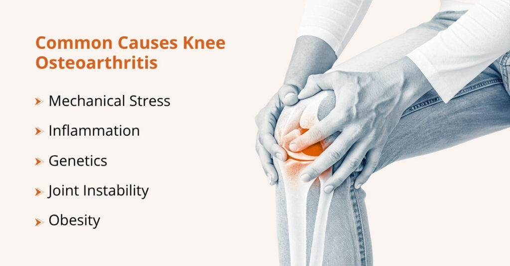 what are the causes of knee osteoarthritis