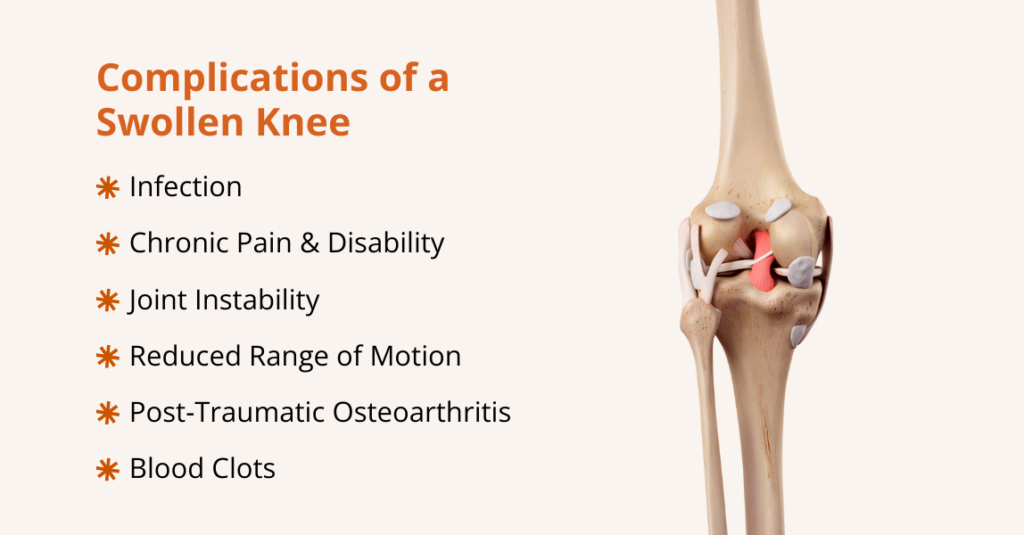 what are the complications of a swollen knee