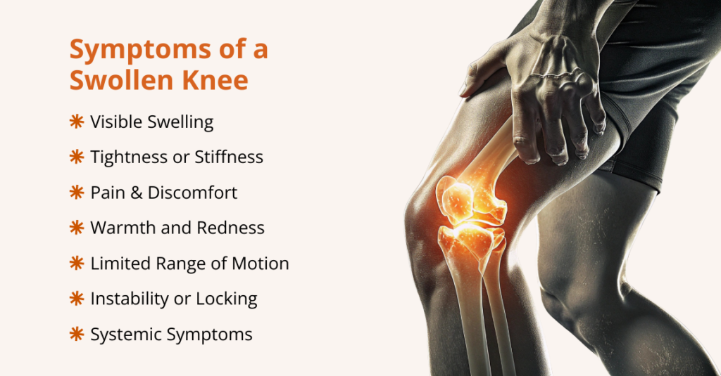 what are the symptoms of a swollen knee