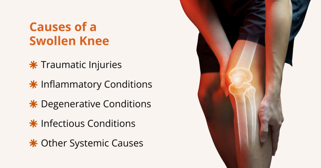 what causes a swollen knee