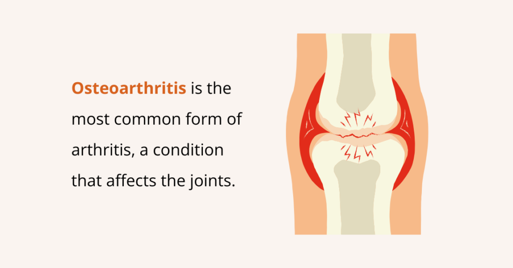 Osteoarthritis 1
